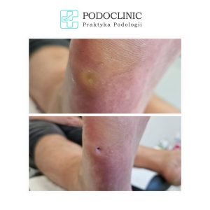 odcisk podoclinic skierniewice